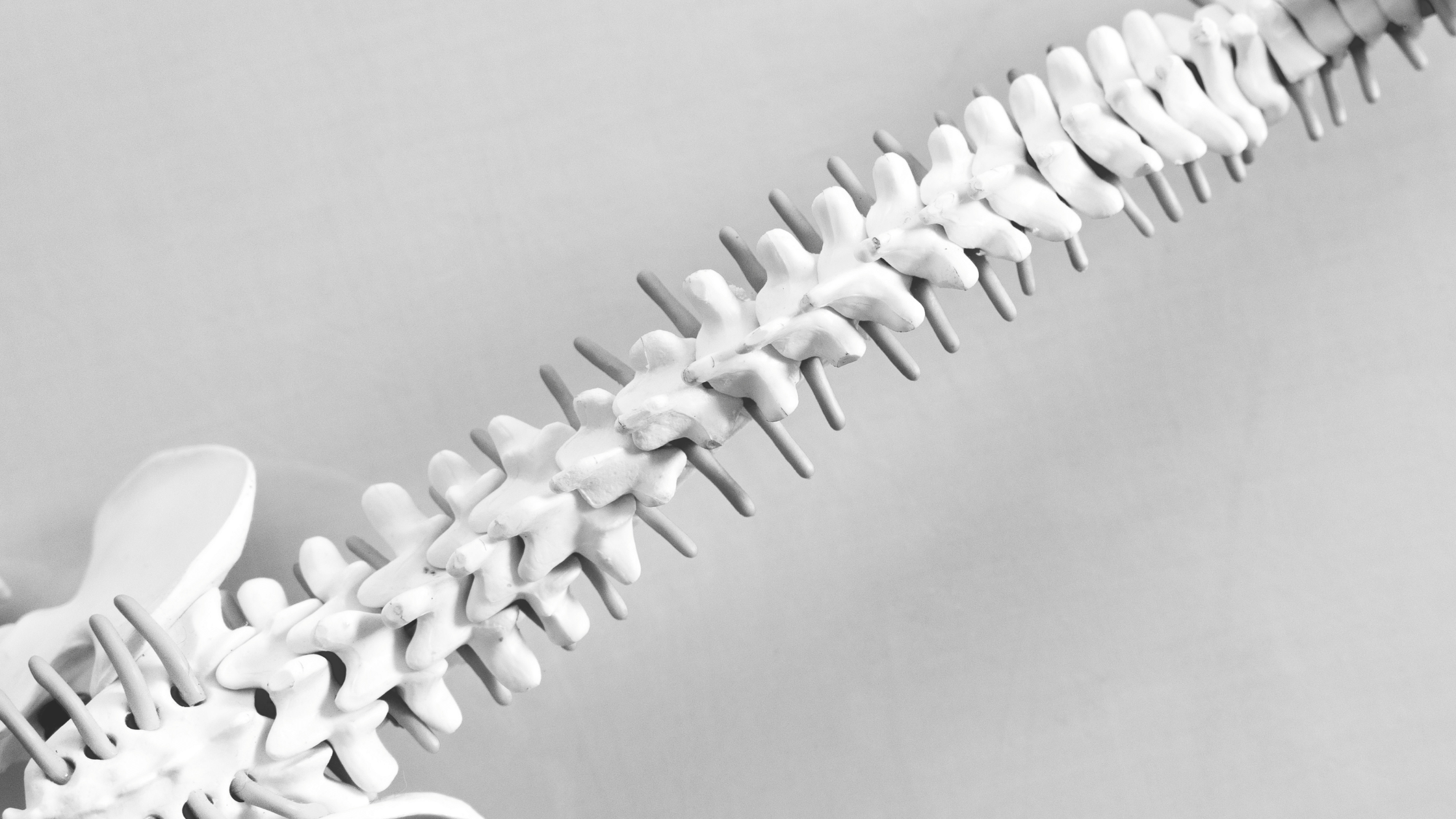 Subluxations: Do They Go Away?